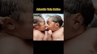 Beautiful Twin Newborn Babies AfterBirth [upl. by Coad]