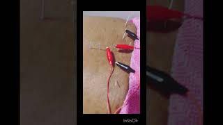 Needling therapy muscleexercises needlingtherapy backpainrelief needlingtherapy electrotherapy [upl. by Aduhey]