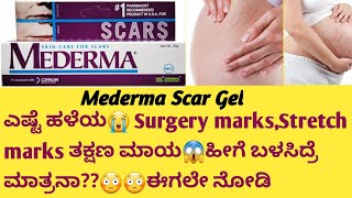 Mederma Scar Gel Review in kannadaUsesside effectssafety Advice surgeryrecovery stretchmarks [upl. by Potter]