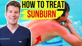 Doctor explains HOW TO TREAT SUNBURN  Top 5 things to do amp avoid to help your skin [upl. by Oswell787]