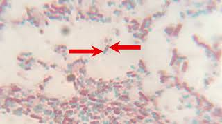 Endospore under Microscope 100X Oil immersion lens [upl. by Enoval]