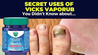 5 Secret Uses of Vicks VapoRub You Didnt Know About [upl. by Mackie]