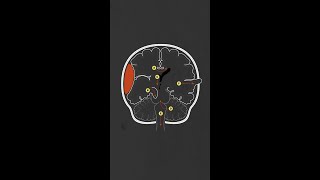 Brain Herniation Syndromes [upl. by Warren]