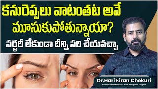 How to Get Rid of Droopy Eyelids Naturally  How to Remove Eye Bags Permanently  ReDefine Channel [upl. by Eislrahc236]