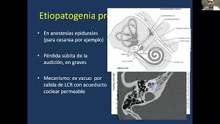 1092024  Hipoacusia Súbita [upl. by Bird]