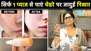 सिर्फ 7 दिन चेहरे पर लगाएं कितने भी मुश्किल झाइयां Melasma कालेधब्बे 100 गायब  DIY Face Serum [upl. by Cowley729]