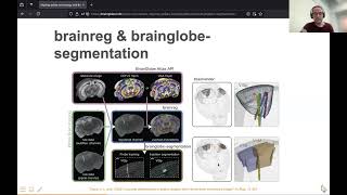 2024 231 Aligning spikes to brains with BrainGlobe Felder [upl. by Ajna]