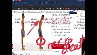 Physical examination of cardiovascular system 1 [upl. by Aihsoem]