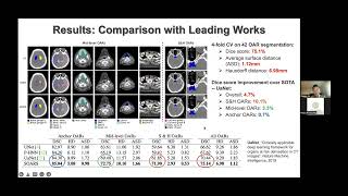 MICCAI Industrial Talk Automated Target Volumes and Organs at Risk Segmentation [upl. by Nnylirak]