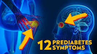 12 Warning Signs of Prediabetes What You Need to Know [upl. by Allayne]