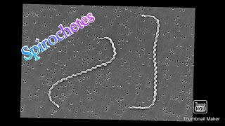 Spirochetes explained in tamil Handwritten notes in Englishmedical microbiology bacteriology [upl. by Mohkos744]