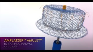 Guide to AFib and Stroke Risk Reduction – Amplatzer Amulet LAA Occluder [upl. by Erle]