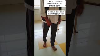 Physical DiagnosisHemiparesisRightcvastroke hemiphysiotherapylearningrehabilitationshorts [upl. by Hgielrahc]