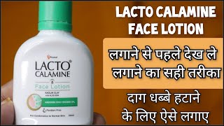 लैक्टो कैलामाइन लोशन Lacto Calamine Face Lotion  Review in hindi How to use lacto calamine lotion [upl. by Ahseret]