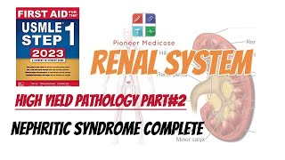 Nephritic Syndrome of Renal System made easy from step 1pathology part 2UrduHindi [upl. by Peg33]