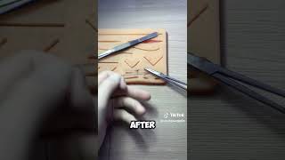 Suturing Techniques medicalstudent nursingschool [upl. by Colier563]