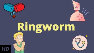 Ringworm Causes Signs and Symptoms Diagnosis and Treatment [upl. by Eiramana518]