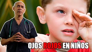 🛑 Mi niño tiene los OJOS ROJOS ✔️ ¿Qué debo hacer Cómo saber si es CONJUNTIVITIS 👈 [upl. by Lemahs]