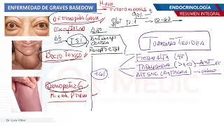 Endocrinología  Graves basedow [upl. by Refiffej582]