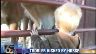 Toddler survives horse kick to face [upl. by Ozkum]