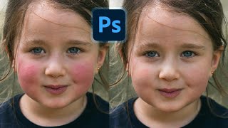 Photoshop Trick Remove Red Patches Easily in Photoshop Skin Color Matching Tips [upl. by Coffee]