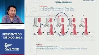 Cirugía pediátrica  1 Atresia de esófago [upl. by Magnolia]