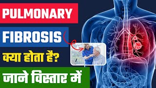 Pulmonary Fibrosis क्या होता है  Pulmonary Fibrosis in Hindi  Understanding Pulmonary Fibrosis [upl. by Noeruat308]