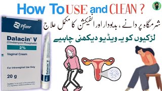 Dalacin v vaginal cream  how to use Clindamycin Phosphate vaginal cream [upl. by Sirromed]