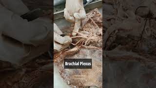 Brachial plexus 1  Anatomy Upper Limb  mbbs neet viral shorts [upl. by Watt901]