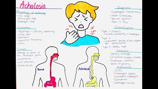 Understanding Achalasia  Causes Symptoms Diagnosis Classification Treatment Differentials [upl. by Roer873]