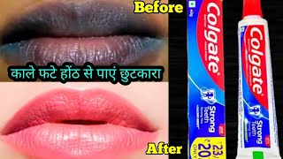 Get Baby Soft Pink Lips in just 1 Day Naturally at Home Easy amp 100 Works [upl. by Jahdal991]