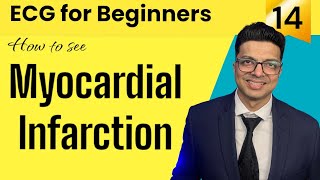 ECG for Beginners  How to see MYOCARDIAL INFARCTION in ECG  जानिए Evolution of MI in ECG [upl. by Aldrich]