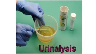 URINALYSIS  How to perform Urinalysis  Urine Dipstick [upl. by Nolyag]