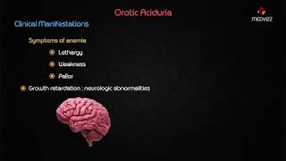 Orotic aciduria  Usmle biochemistry case based discussion [upl. by Ennovad]