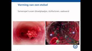 Hemostase deel 1 Inleiding  Prof dr REG Schutgens [upl. by Aiceled994]