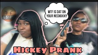 HICKEY PRANK GONE WRONG 🤬🤬 [upl. by Euton]