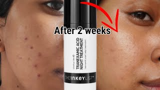 The Inkey List Tranexamic Acid Overnight Treatment Review with Results  How to use it [upl. by Nospmas]