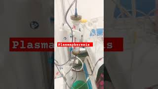 Plasmapheresis  T amp E Plasma transfusion During Dialysis  Kidney Disease  shortsfeedviralshort [upl. by Ecire]