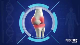 Flexiseq Akıllı Jel ile Eklem Ağrılarınızdan Kurtulun [upl. by Rahel]