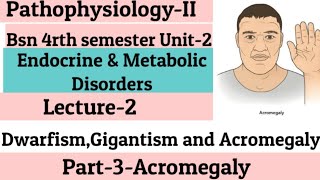 AcromegalyUnit2Endocrine amp Metabolic DisordersLecture2DwarfismGigantism AcromegalyPart3 [upl. by Sutit683]