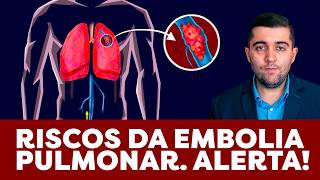 Como melhorar rápido da embolia pulmonar limpe agora coágulos sanguíneos da trombose nos pulmões [upl. by Poul]