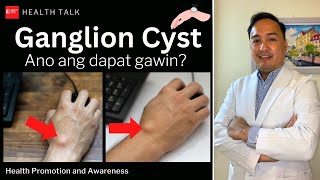 Ganglion Cyst Causes Risk factors Diagnosis Treatment and Prevention [upl. by Ahsinnek992]