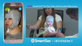 SmartSoc® SmartCam™ for Fast Safe and Accurate Video Scans [upl. by Forkey543]