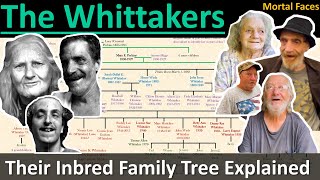 THE WHITTAKERS A West Virginia Inbred Family Tree Explained Mortal Faces [upl. by Gabriellia]