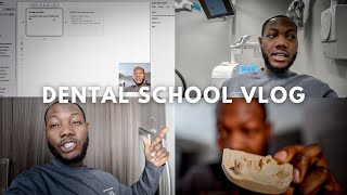 Dental School Vlog Preparing My Boards Study Schedule Fixed amp Removable Prosthodontics Are Back [upl. by Idahs]