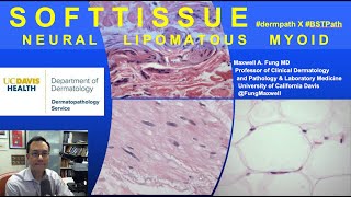 DERMATOPATHOLOGY Soft Tissue Tumors Neural Lipomatous Myoid [upl. by Beora178]