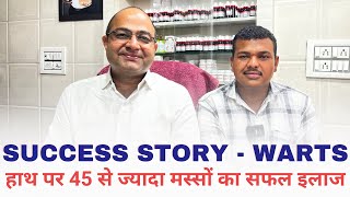 45 से ज्यादा हाथ पर मस्सों का होम्योपैथिक में सफल इलाज  Warts Success Story [upl. by Seymour]