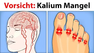 3 Anzeichen von akutem KaliumMangel [upl. by Tehc]