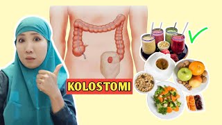 INI NUTRISI YG BISA KAMU KONSUMSI SETELAH OPERASI KOLOSTOMI [upl. by Bannister]