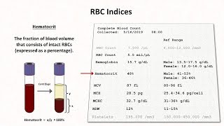 How to Interpret RBC Indices eg hemoglobin vs hematocrit MCV RDW [upl. by Leavy]